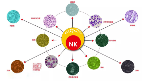 多种癌症的实验性治疗选择—CAR NK细胞疗法及领跑企业